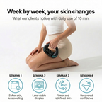 NEXLY™ | Advanced Deep Fascia Cellulite Massager